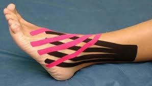 kinesiotape